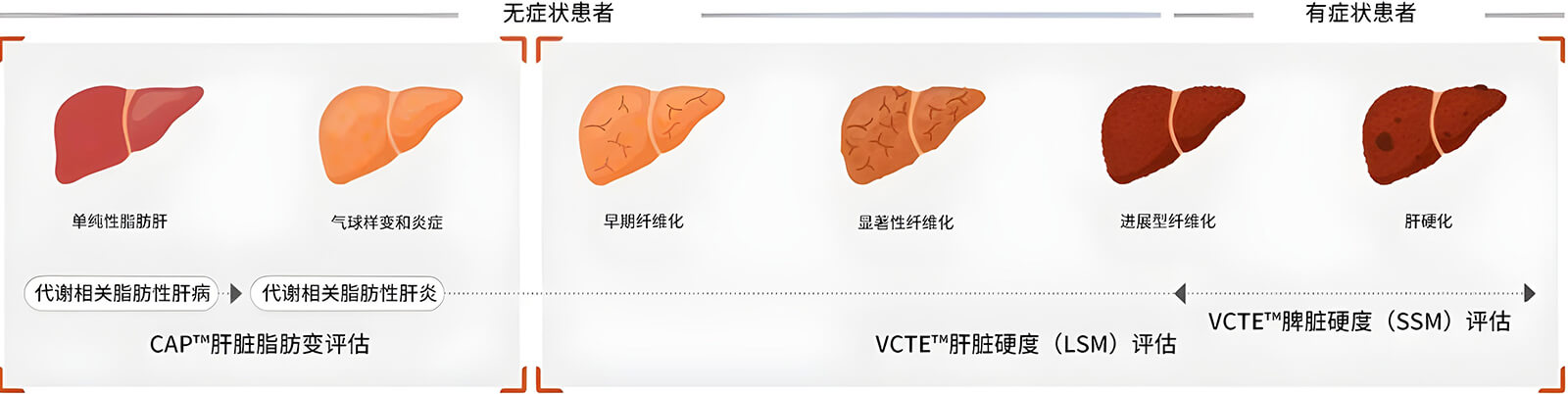 Deux technologies clés FibroScan®
