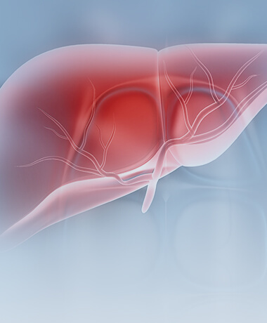 Solutions pour les personnes à haut risque de cancer du foie